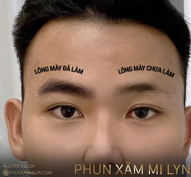 XĂM CHÂN MÀY NAM