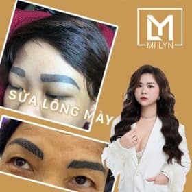 Địa chỉ sửa lông mày hỏng Hải Phòng