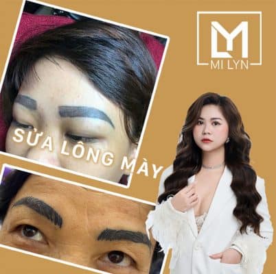 Địa chỉ sửa lông mày hỏng Hải Phòng