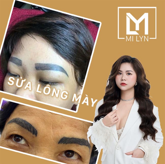 Địa chỉ sửa lông mày hỏng Hải Phòng