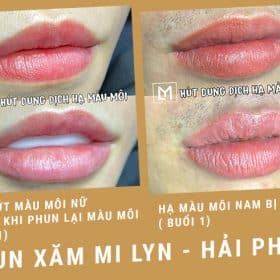 Địa chỉ sửa môi phun xăm hỏng ở hải phòng