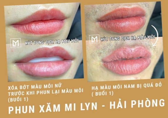 Địa chỉ sửa môi phun xăm hỏng ở hải phòng
