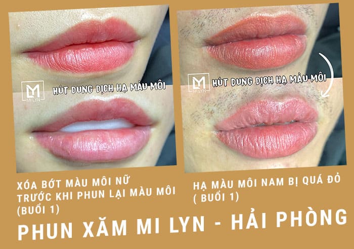 Địa chỉ sửa môi phun xăm hỏng ở hải phòng