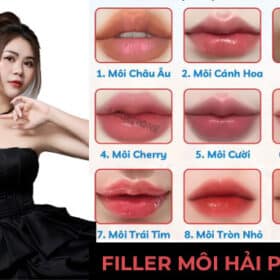 TIÊM FILLER MÔI HẢI PHÒNG MI LYN